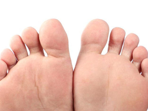 Natural, home remedies for gout